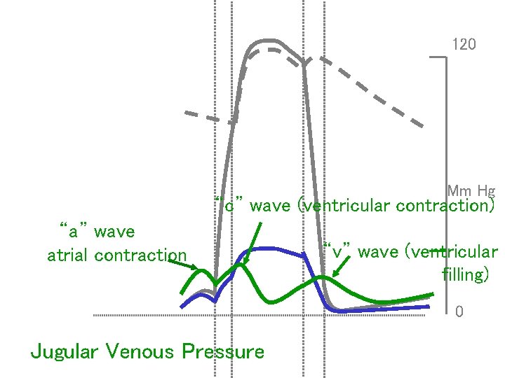 120 Mm Hg “c” wave (ventricular contraction) “a” wave atrial contraction “v” wave (ventricular