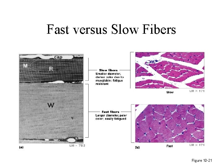 Fast versus Slow Fibers Figure 10– 21 Fast versus Slow Fibers Figure 10– 21