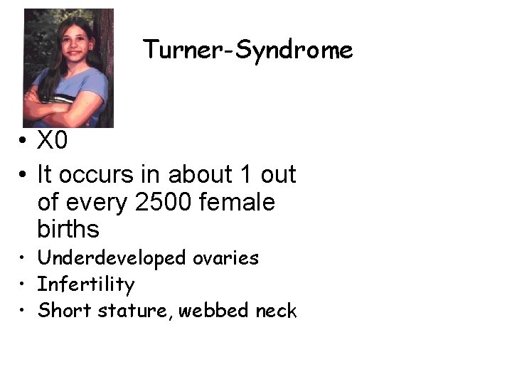 Turner-Syndrome • X 0 • It occurs in about 1 out of every 2500