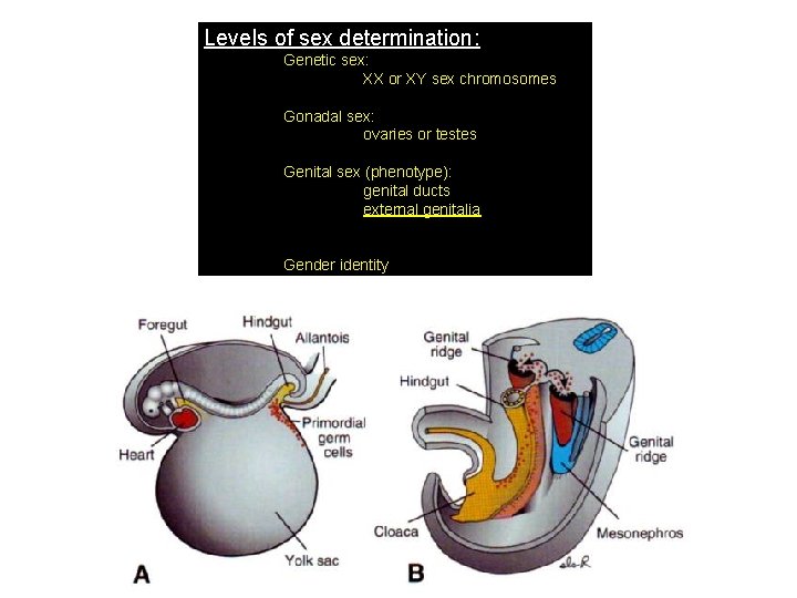 Levels of sex determination: Genetic sex: XX or XY sex chromosomes Gonadal sex: ovaries