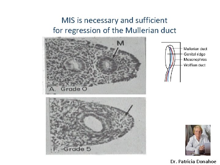 MIS is necessary and sufficient for regression of the Mullerian duct Dr. Patricia Donahoe