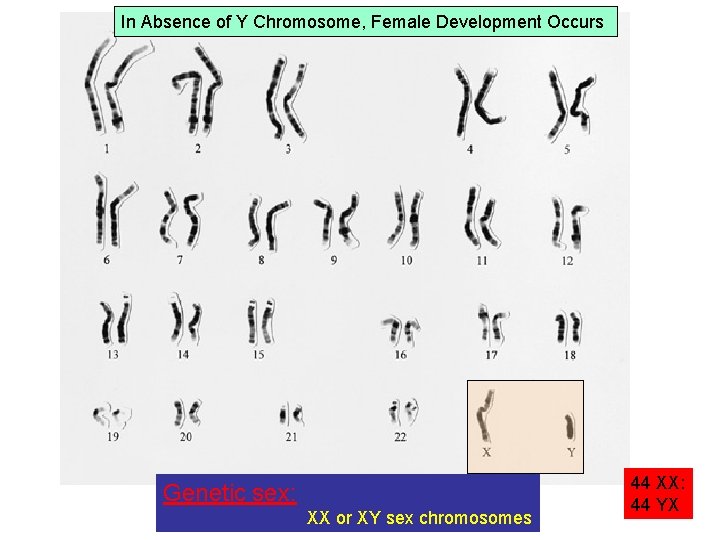 In Absence of Y Chromosome, Female Development Occurs Genetic sex: XX or XY sex