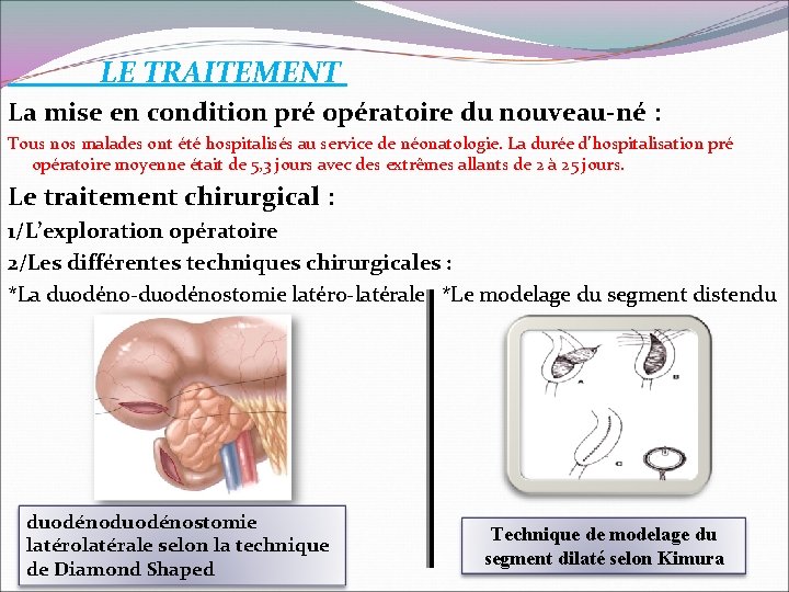  LE TRAITEMENT La mise en condition pré opératoire du nouveau-né : Tous nos