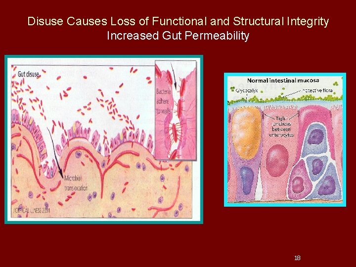 Disuse Causes Loss of Functional and Structural Integrity Increased Gut Permeability 18 