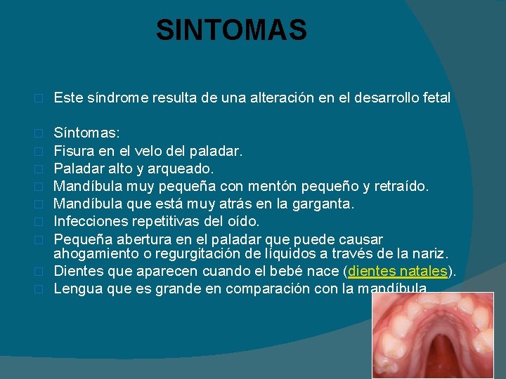 SINTOMAS � Este síndrome resulta de una alteración en el desarrollo fetal Síntomas: Fisura