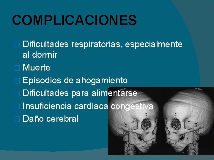 COMPLICACIONES � Dificultades respiratorias, especialmente al dormir � Muerte � Episodios de ahogamiento �