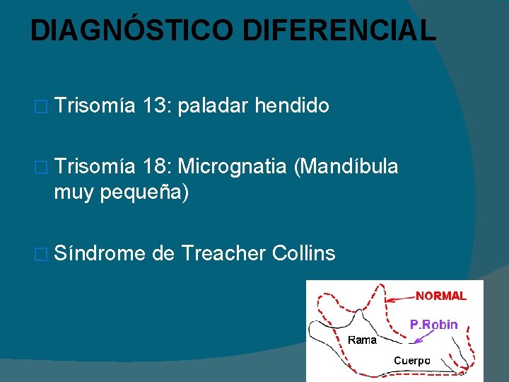 DIAGNÓSTICO DIFERENCIAL � Trisomía 13: paladar hendido � Trisomía 18: Micrognatia (Mandíbula muy pequeña)