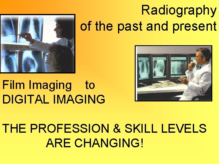 Radiography of the past and present Film Imaging to DIGITAL IMAGING THE PROFESSION &