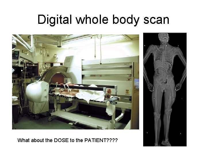 Digital whole body scan What about the DOSE to the PATIENT? ? 