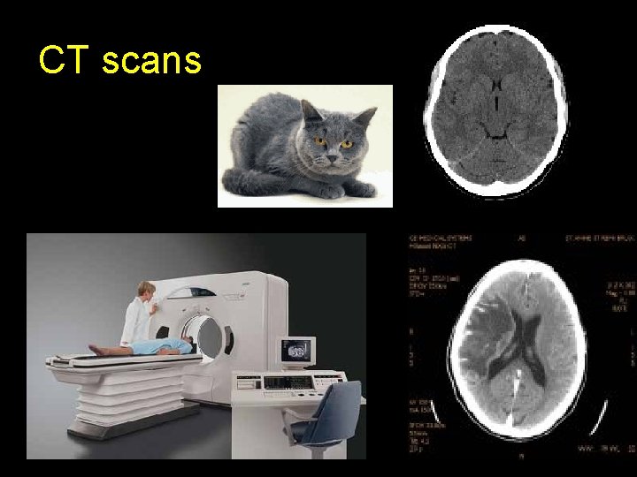 CT scans 