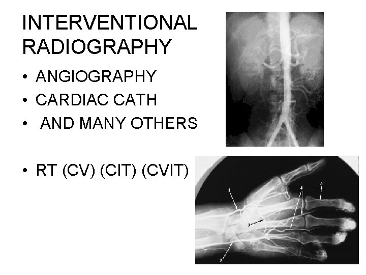 INTERVENTIONAL RADIOGRAPHY • ANGIOGRAPHY • CARDIAC CATH • AND MANY OTHERS • RT (CV)