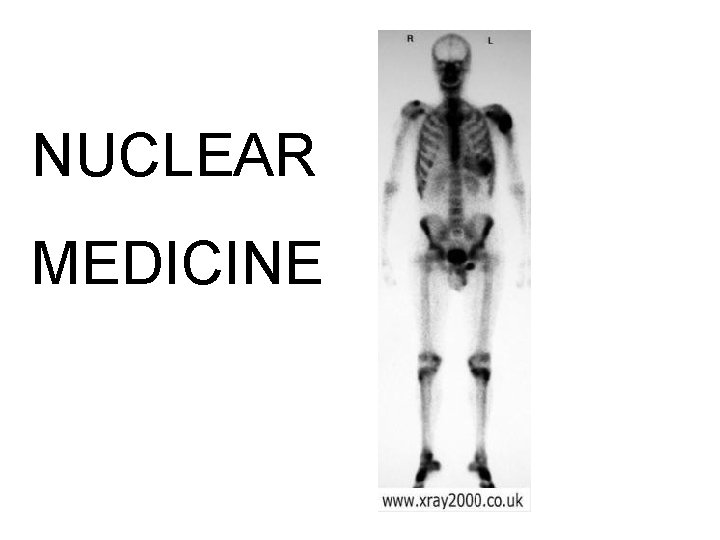 NUCLEAR MEDICINE 