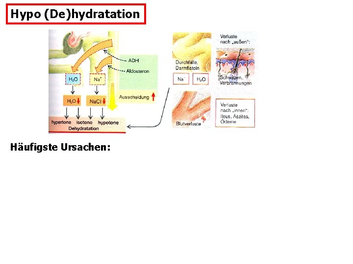 Hypo (De)hydratation Häufigste Ursachen: 