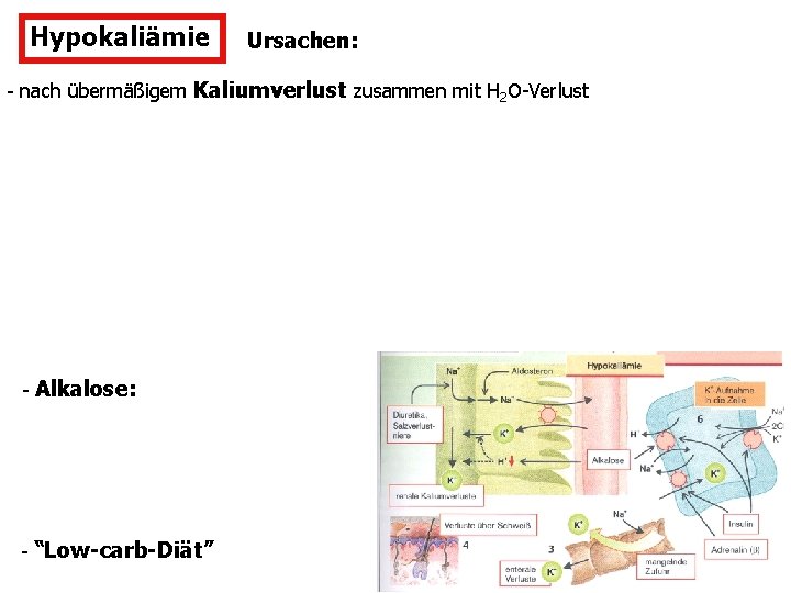 Hypokaliämie Ursachen: - nach übermäßigem Kaliumverlust zusammen mit H 2 O-Verlust - Alkalose: -