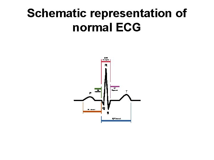 Schematic representation of normal ECG 