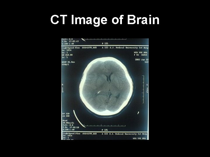 CT Image of Brain 