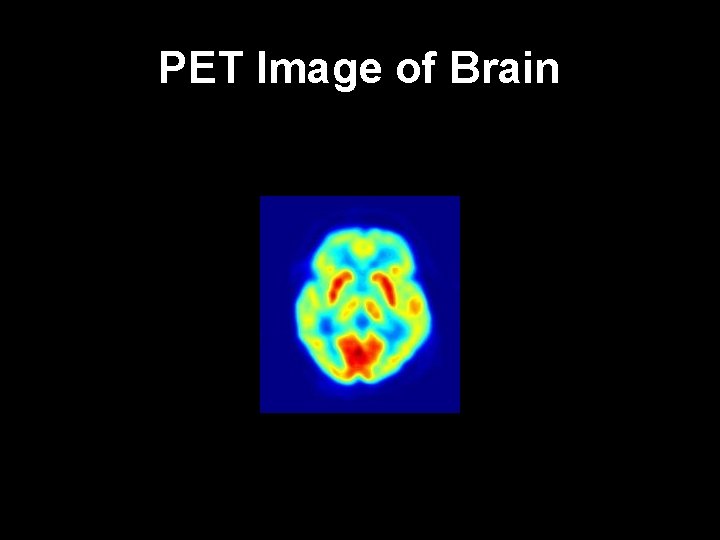 PET Image of Brain 