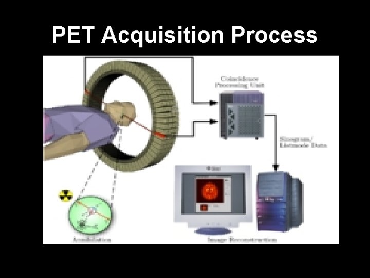 PET Acquisition Process 