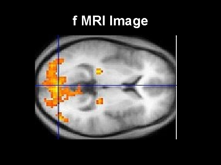 f MRI Image 