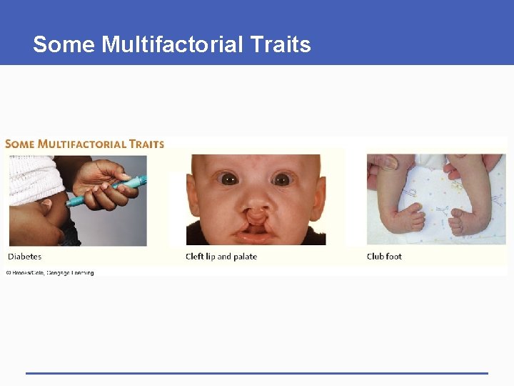 Some Multifactorial Traits 