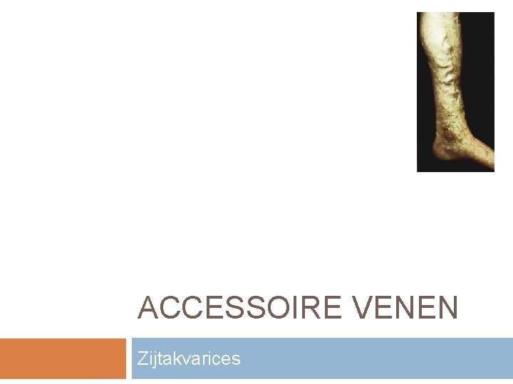 ACCESSOIRE VENEN Zijtakvarices 