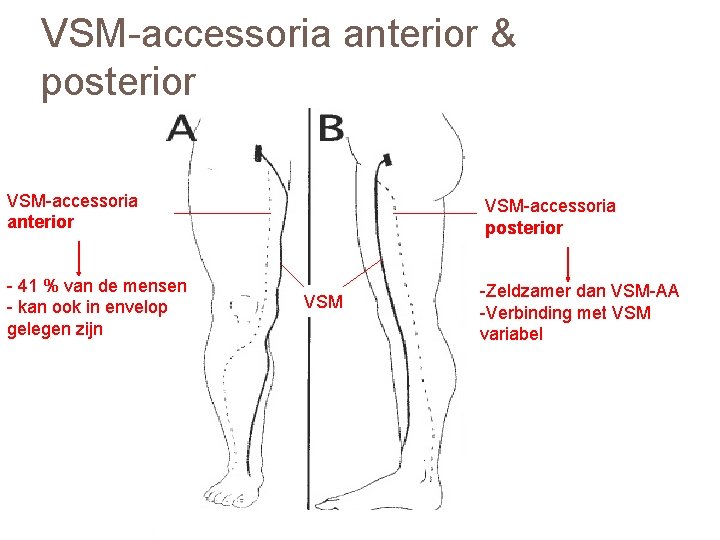 VSM-accessoria anterior & posterior VSM-accessoria anterior - 41 % van de mensen - kan