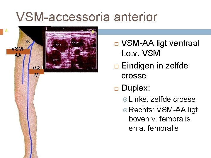 VSM-accessoria anterior VSMAA VS M VSM-AA ligt ventraal t. o. v. VSM Eindigen in