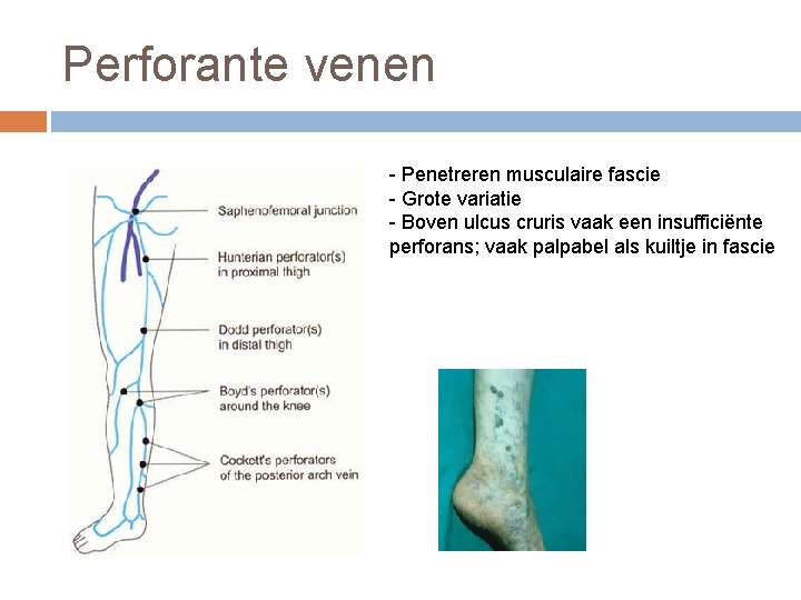 Perforante venen - Penetreren musculaire fascie - Grote variatie - Boven ulcus cruris vaak