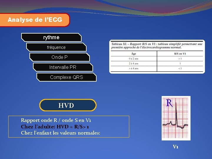 Analyse de l’ECG rythme fréquence Onde P Intervalle PR Complexe QRS HVD Rapport onde