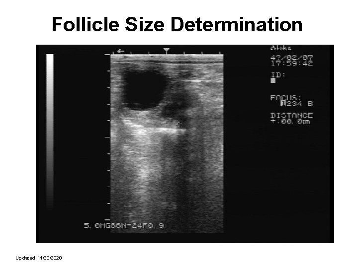 Follicle Size Determination Updated: 11/30/2020 