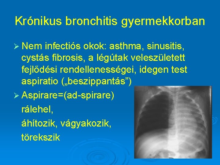 Krónikus bronchitis gyermekkorban Ø Nem infectiós okok: asthma, sinusitis, cystás fibrosis, a légútak veleszületett