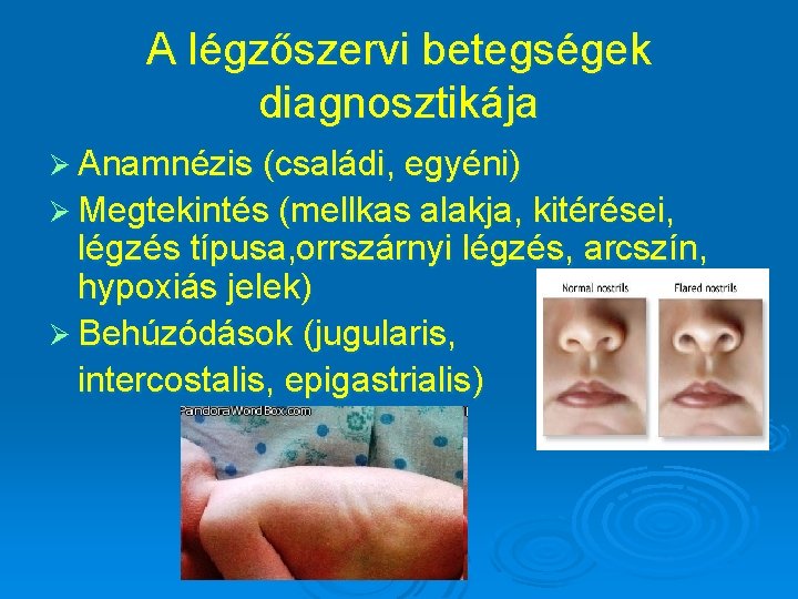 A légzőszervi betegségek diagnosztikája Ø Anamnézis (családi, egyéni) Ø Megtekintés (mellkas alakja, kitérései, légzés