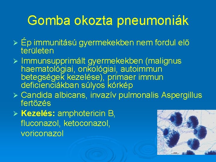 Gomba okozta pneumoniák Ép immunitású gyermekekben nem fordul elő területen Ø Immunsupprimált gyermekekben (malignus