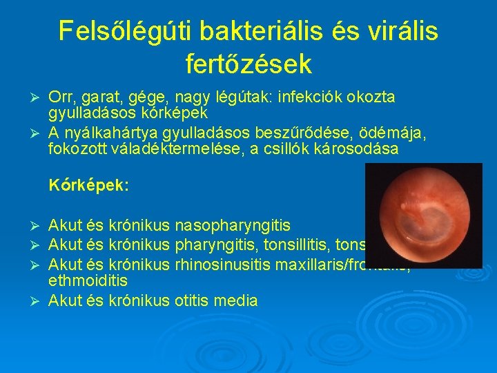 Felsőlégúti bakteriális és virális fertőzések Orr, garat, gége, nagy légútak: infekciók okozta gyulladásos kórképek