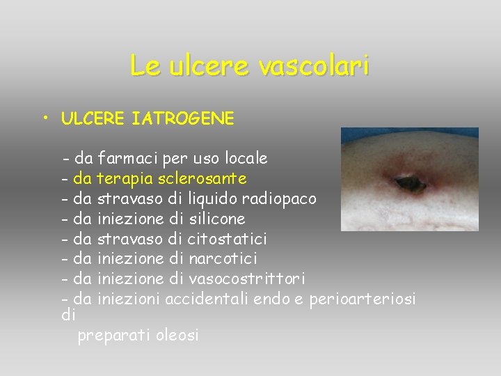 Le ulcere vascolari • ULCERE IATROGENE - da farmaci per uso locale - da Le ulcere vascolari • ULCERE IATROGENE - da farmaci per uso locale - da