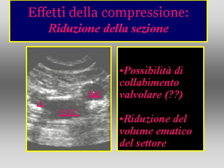 Effetti della compressione: Riduzione della sezione Saf. A. V. F. C. • Possibilità di Effetti della compressione: Riduzione della sezione Saf. A. V. F. C. • Possibilità di