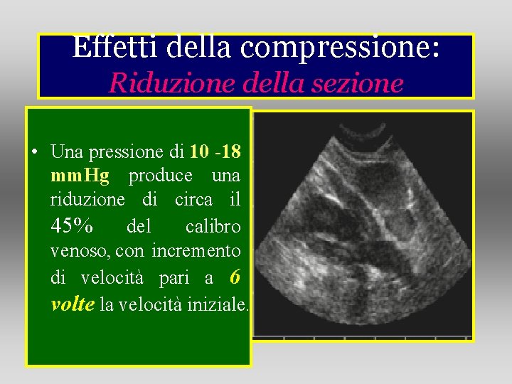 Effetti della compressione: Riduzione della sezione • Una pressione di 10 -18 mm. Hg Effetti della compressione: Riduzione della sezione • Una pressione di 10 -18 mm. Hg