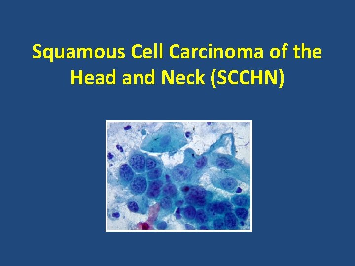 Squamous Cell Carcinoma of the Head and Neck (SCCHN) 