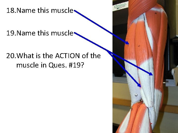 18. Name this muscle 19. Name this muscle 20. What is the ACTION of