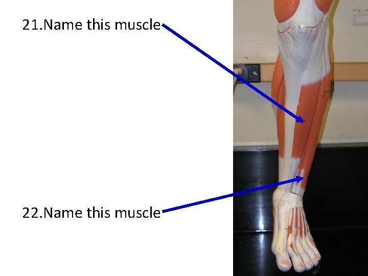 21. Name this muscle 22. Name this muscle 