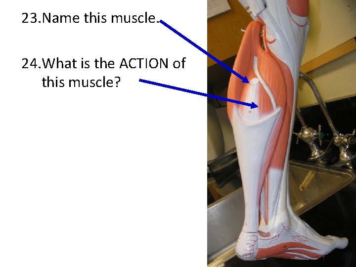 23. Name this muscle. 24. What is the ACTION of this muscle? 