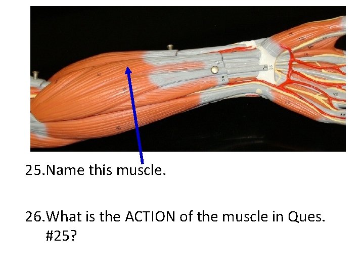 25. Name this muscle. 26. What is the ACTION of the muscle in Ques.