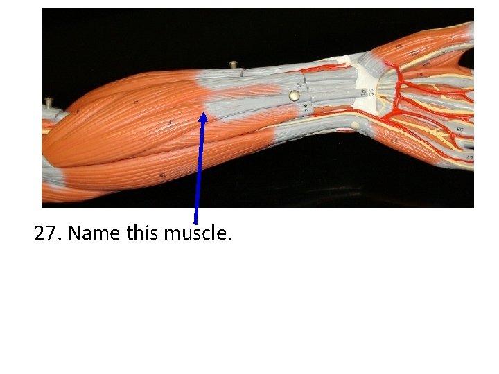 27. Name this muscle. 