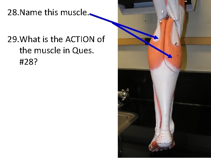 28. Name this muscle. 29. What is the ACTION of the muscle in Ques.