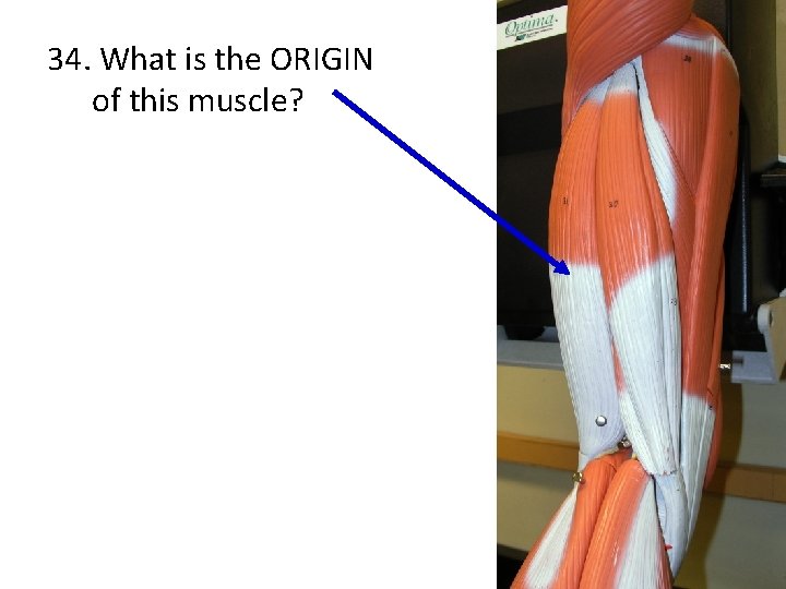 34. What is the ORIGIN of this muscle? 