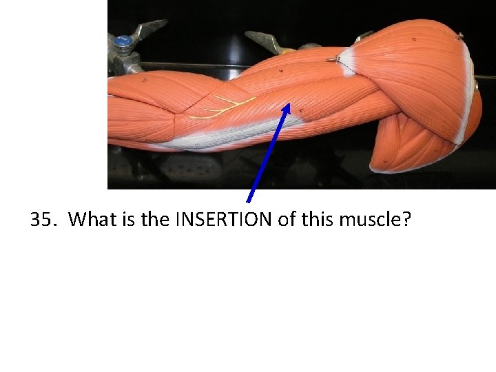 35. What is the INSERTION of this muscle? 