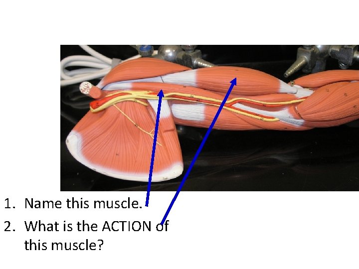 1. Name this muscle. 2. What is the ACTION of this muscle? 