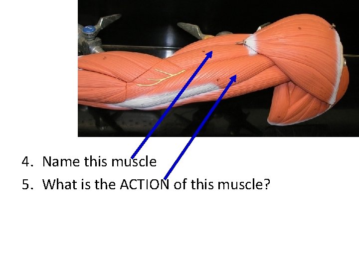 4. Name this muscle 5. What is the ACTION of this muscle? 