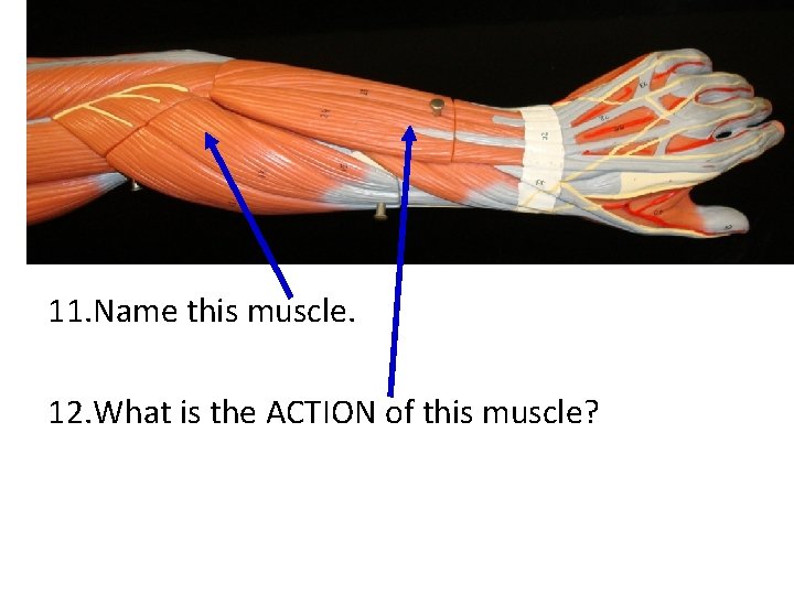 11. Name this muscle. 12. What is the ACTION of this muscle? 