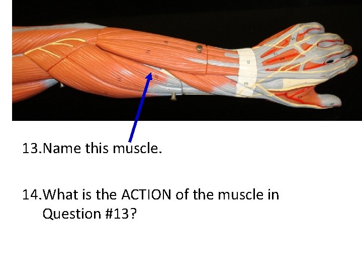 13. Name this muscle. 14. What is the ACTION of the muscle in Question